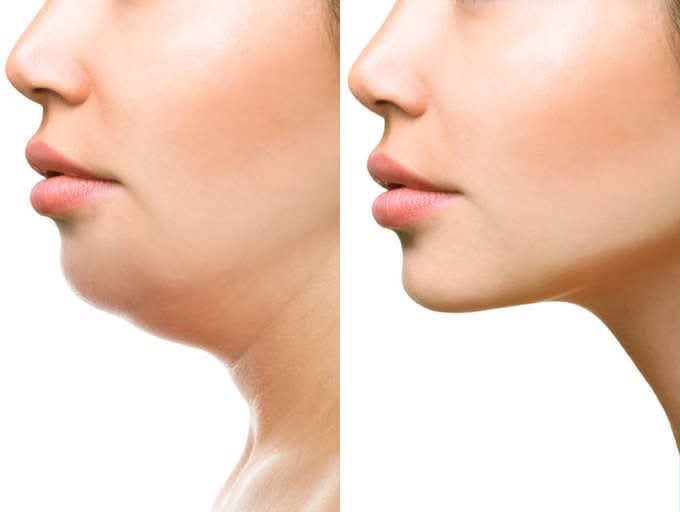 Face Slimming Mask For Double Chin Breathable V Shape Lifting Belt .