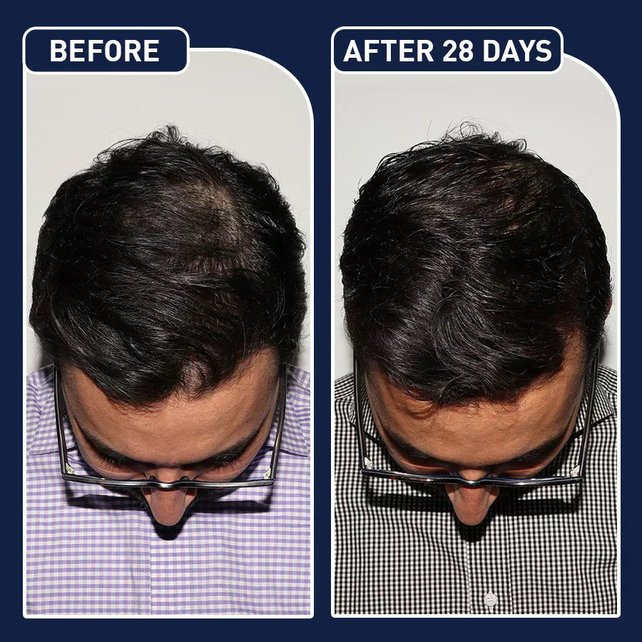 FEG Hair Growth Spray
