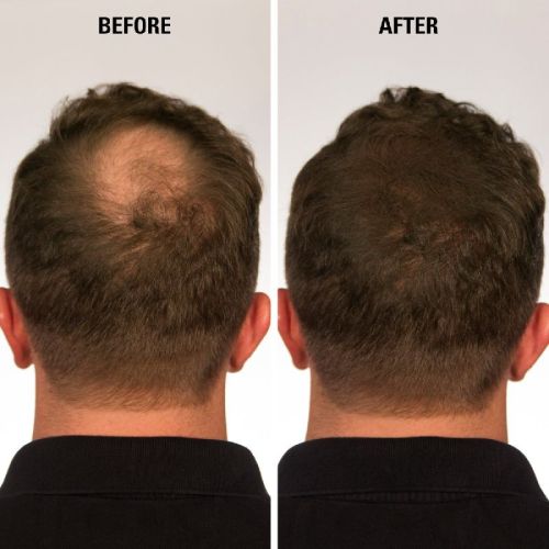 Hair Filler Powder